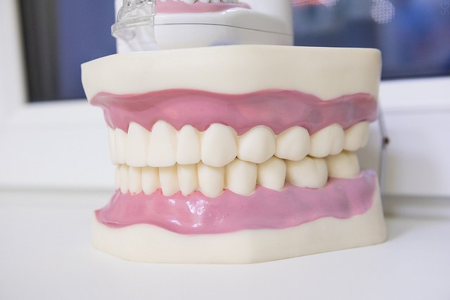 Новое поколение стоматологических материалов: предупреждение вторичного кариеса